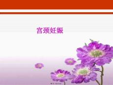 宫颈妊娠.pptx
