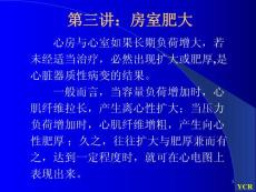 三房室肥大