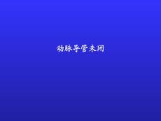 动脉导管未闭