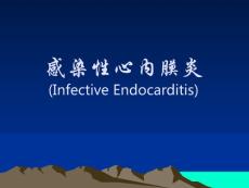 感染性心内膜炎