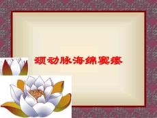 颈动脉海绵窦瘘培训课件