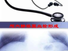 颅内静脉窦血栓形成培训课件
