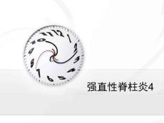 强直性脊柱炎4