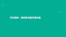 肺转移性腺样囊性癌-课件