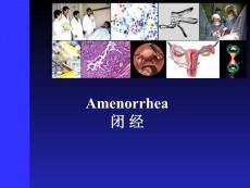 一 闭经.ppt