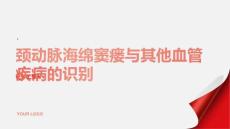 健康课堂之如何识别颈动脉海绵窦瘘与其他血管疾病