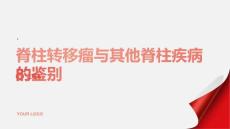 健康课堂之脊柱转移瘤与其他脊柱疾病的鉴别要点了解一下