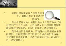 酒精肝的临床表现.ppt