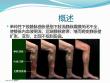 齐鲁医学单纯性下肢静脉曲张.pptx