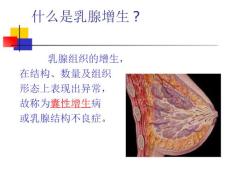 乳腺增生.ppt