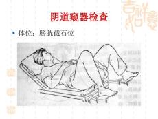 分泌物检查.ppt