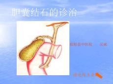 胆结石PPT