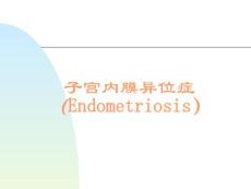 子宫内膜异位症_2