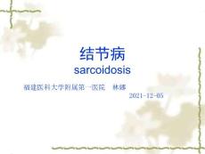结节病课件