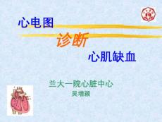 心电图诊断心肌缺血