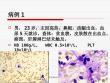 再生障碍性贫血
