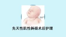 先天性肌性斜颈术后护理