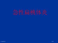 急性扁桃体炎