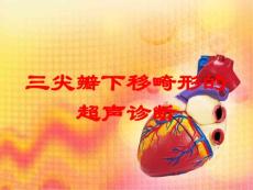 三尖瓣下移畸形的超声诊断培训课件