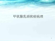 甲状腺乳头状癌
