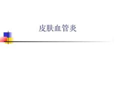 皮肤血管炎的识别