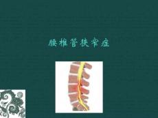腰椎管狭窄症