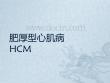肥厚型心肌病
