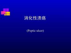 消化性溃疡课件