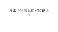异常子宫出血宫腔镜诊治