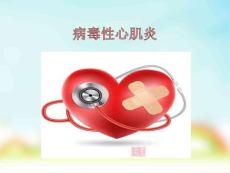 病毒性心肌炎