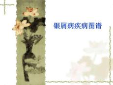 银屑病疾病图谱