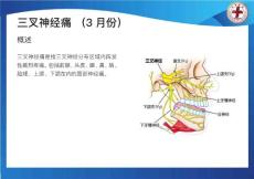 健康宣教——三叉神经痛