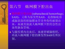 蛛网膜下腔出血