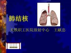 钙化肺结核