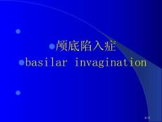 颅底陷入症专题知识宣讲