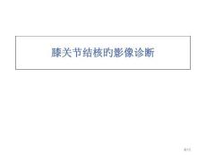 膝关节结核的影像学诊疗培训课件