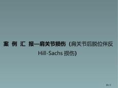肩关节损伤肩关节后脱位伴反HillSachs损伤培训课件培训课件