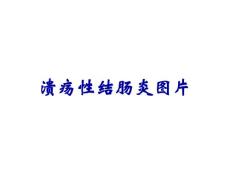 溃疡性结肠炎图片