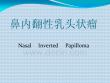 鼻内翻性乳头状瘤培训课件