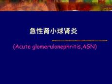 急性肾小球肾炎