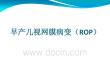 早产儿视网膜病变培训课件