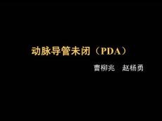 动脉导管未闭