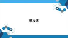硬皮病专题知识讲座