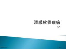 SC滑膜软骨瘤病