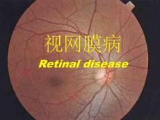 视网膜病图谱培训课件