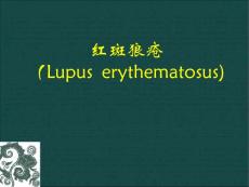 红斑狼疮课件ppt课件