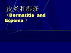 接触性皮炎PPT培训课件