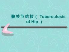 髋关节结核专题宣讲PPT培训课件