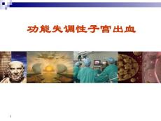 异常子宫出血功能失调性子宫出血课件培训课件