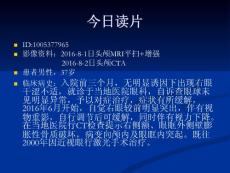 眼眶表皮样囊肿培训课件